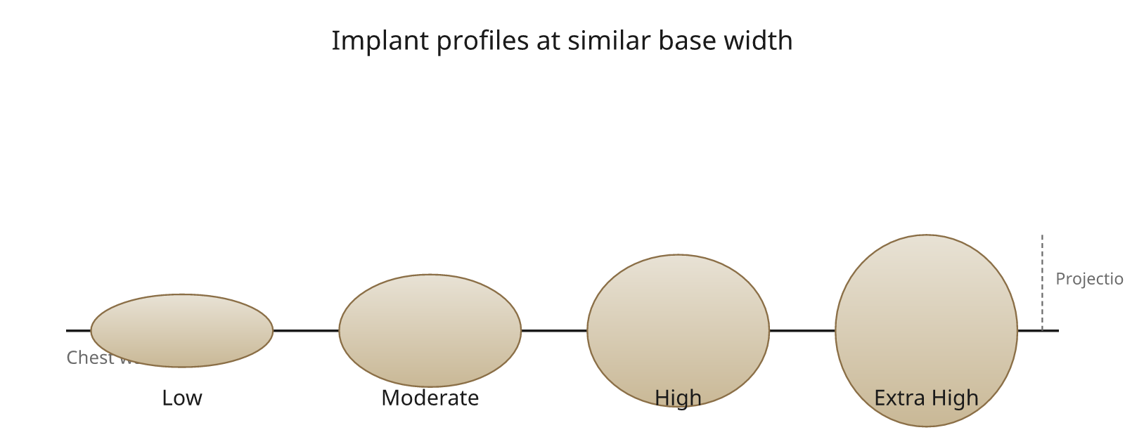 Dimensions That Define an Implant